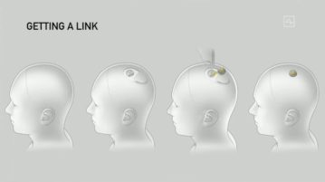 Neuralink: Elon Musk presentó su plan para implantar chips en el cerebro Negocios en Salta